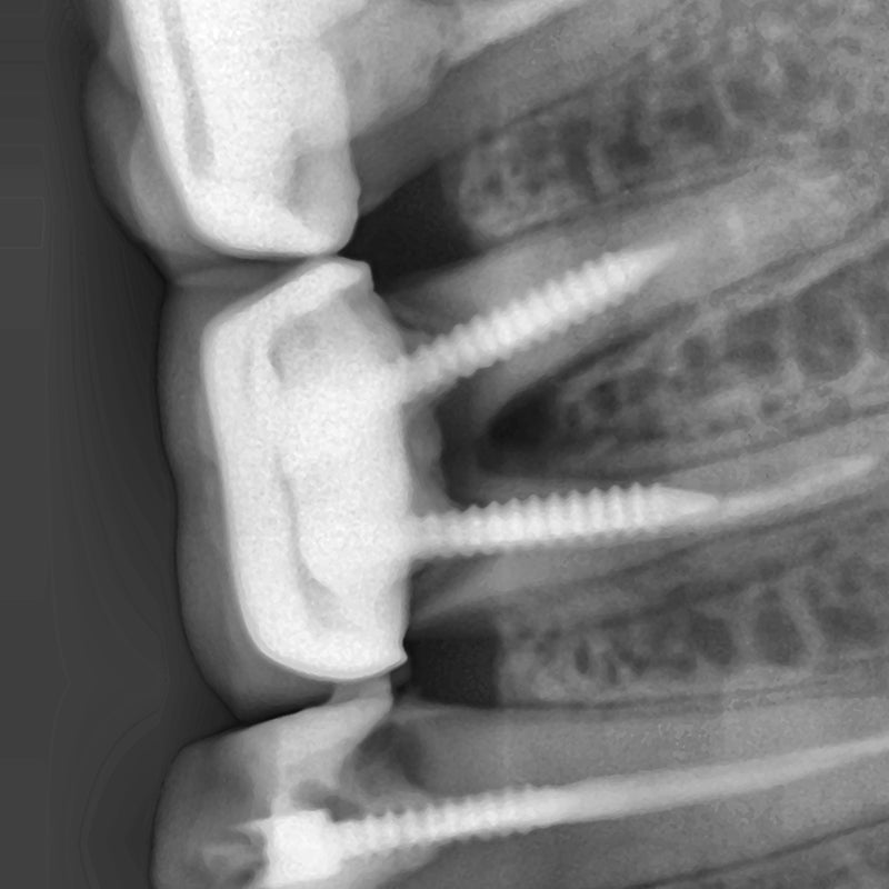 Bondent Bondream Air - Dental Portable Dental X-ray Device
