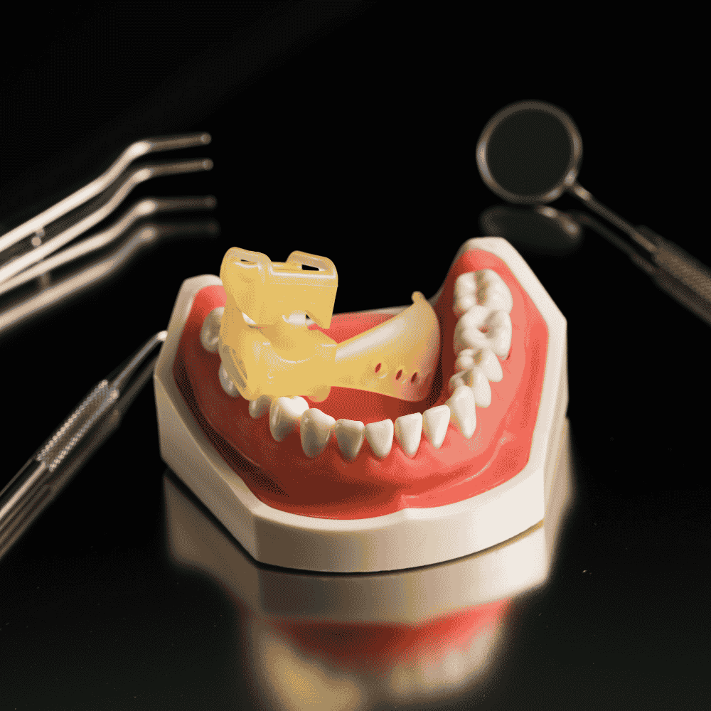 Tonguardian Dental Retractor